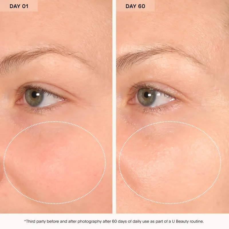 The Barrier Bioactive Treatment