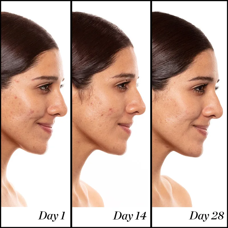 A+ High-Dose Retinoid Serum
