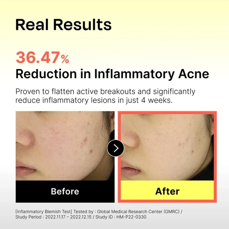 131 Pore Clearing Serum