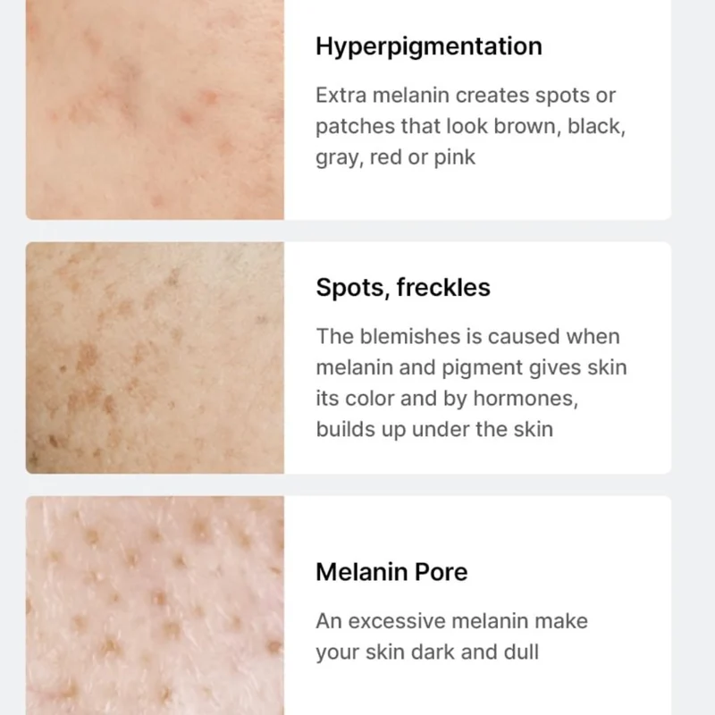 Pore + Dark Spot Brightening Kit