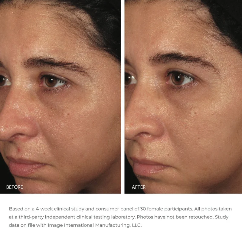 ORMEDIC balancing biopeptide crème | IMAGE Skincare