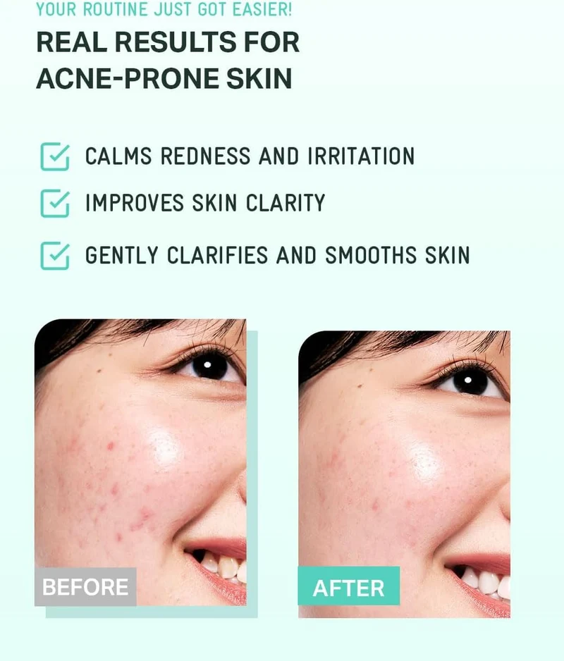 Tea Tree Cica Soothing Toner