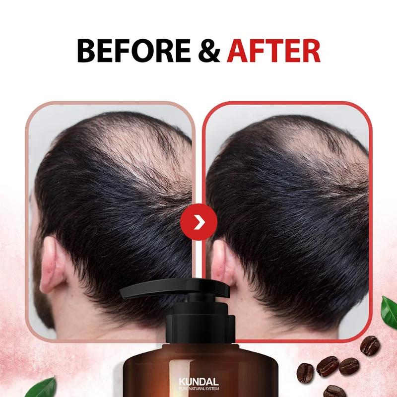 Caffeine Shampoo