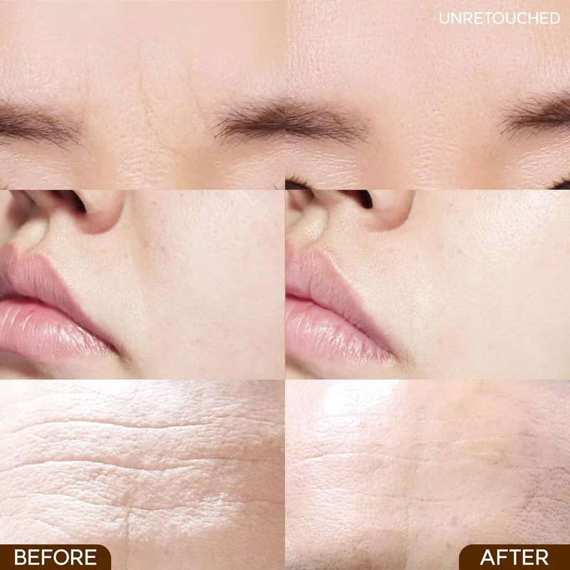 Wrinkle Repair Frown Line Patch
