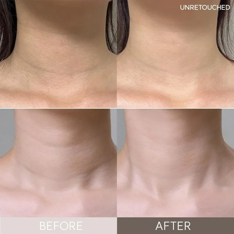 Wrinkle Repair Hydrogel Neck Patch