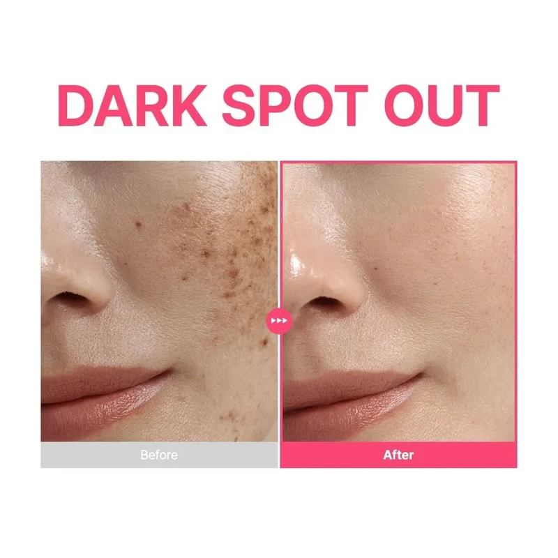 TXA 6 Niacinamide 10 Retinal Serum