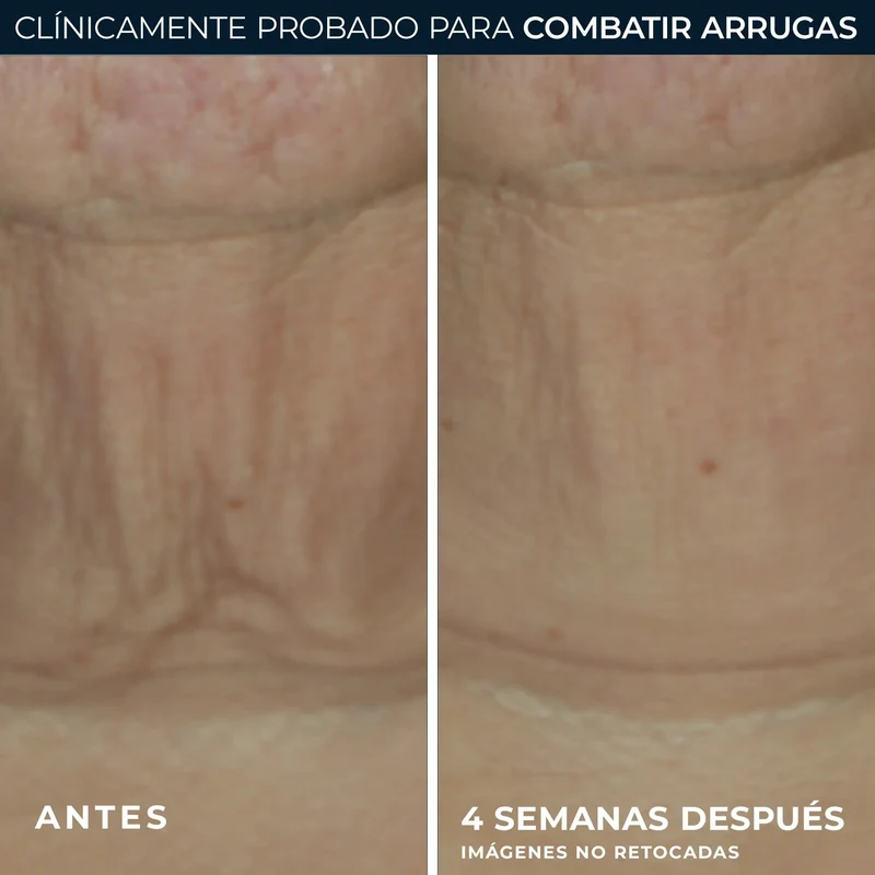 Roc Skincare Iberia Roc® Derm Correxion® Firming Stick 30G